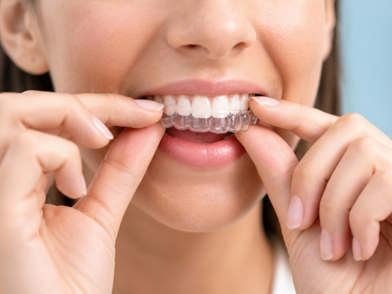 Woman adjusting clear dental aligners on teeth